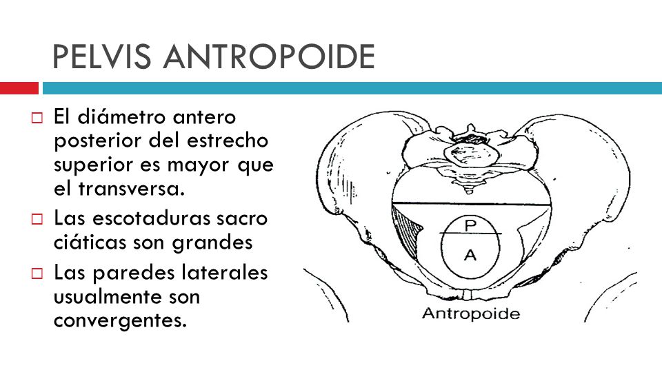 Que es la pelvis androide
